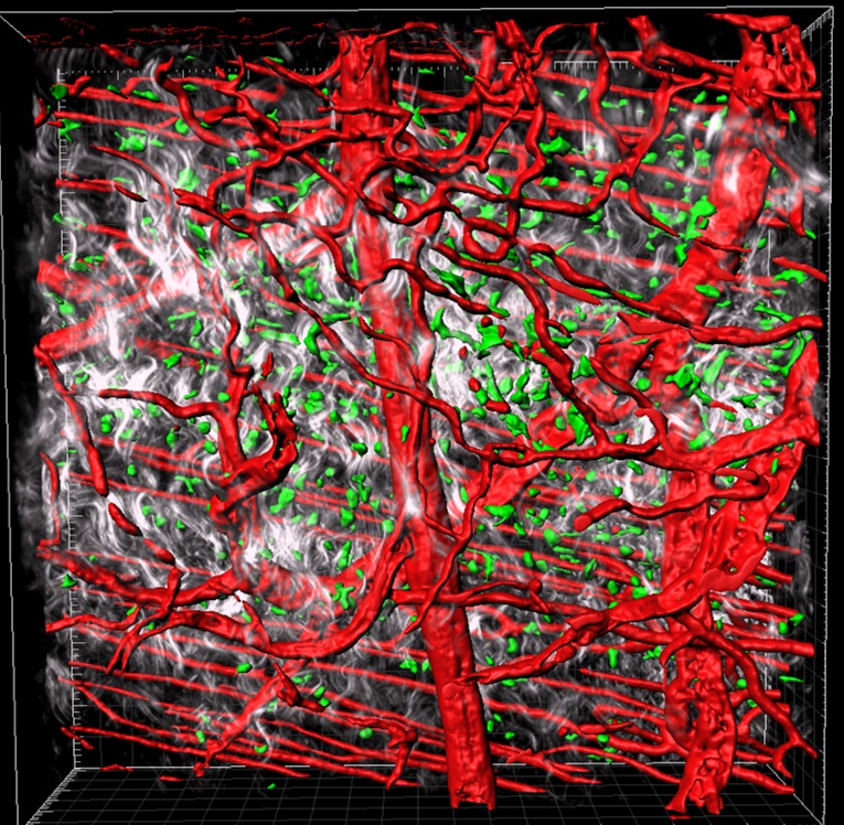 Jenna Cash Early Career Fellowship chronic wounds research. Why do some wounds fail to heal?